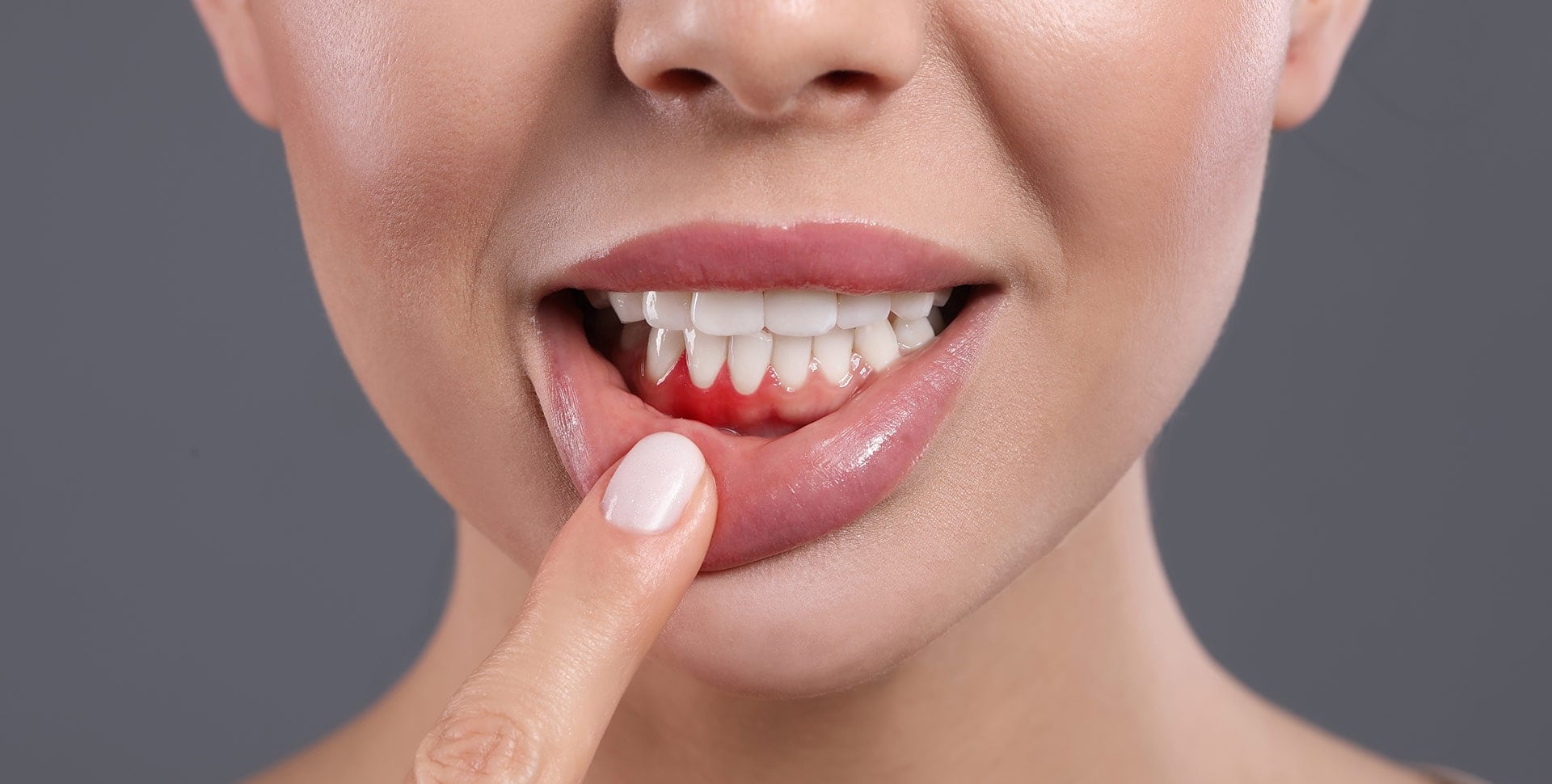 Gingival Graft Arlington VA